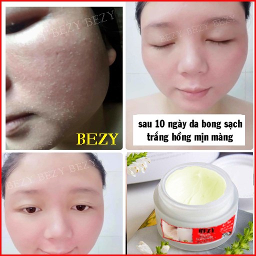 Kem BEZY Bong Da Mặt Xóa Thâm Nám Sạm Trắng Da ( Bong nhanh sau 5 ngày)