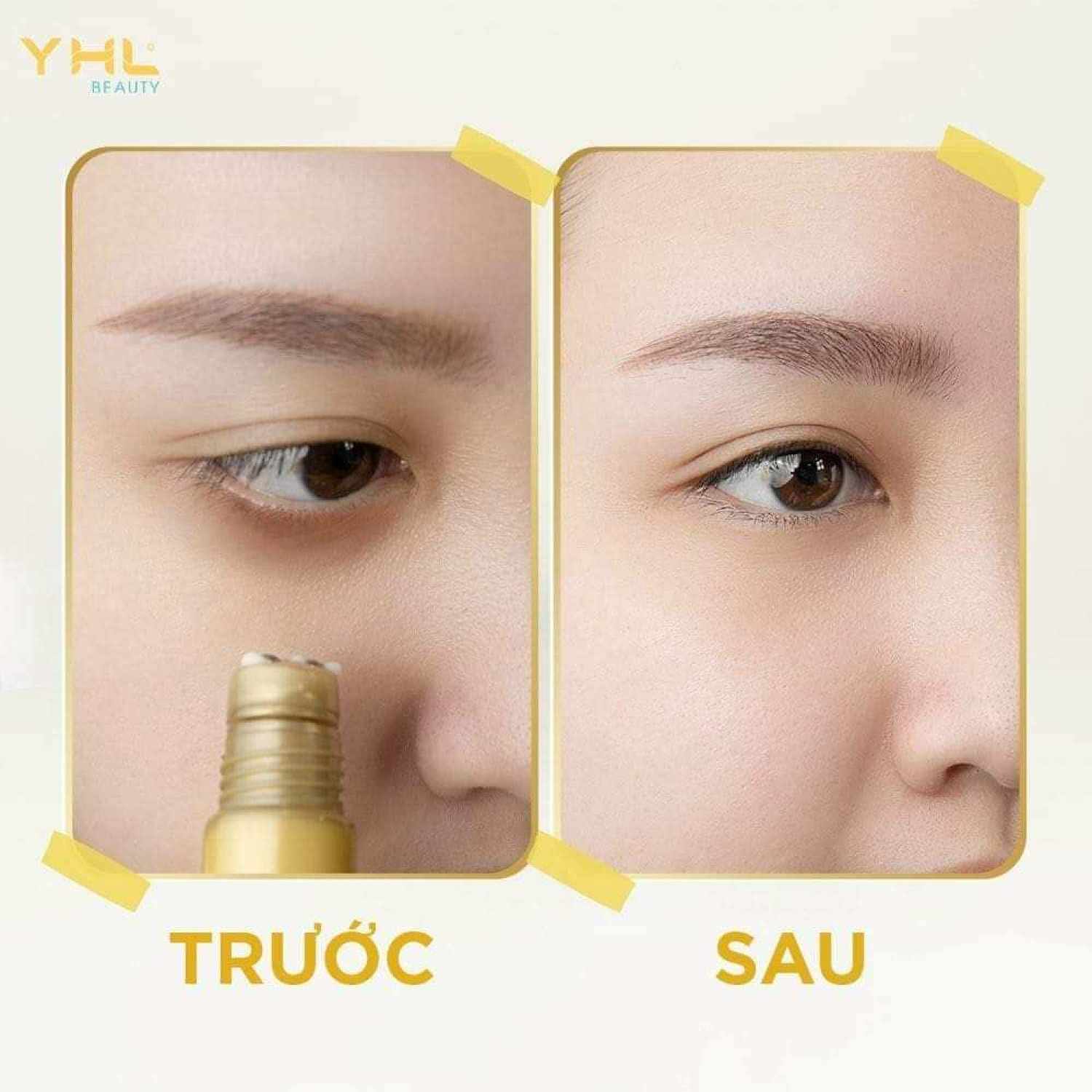 KEM DƯỠNG DA VÙNG MẮT YHL[ CHÍNH HÃNG SX TẠI ÚC]