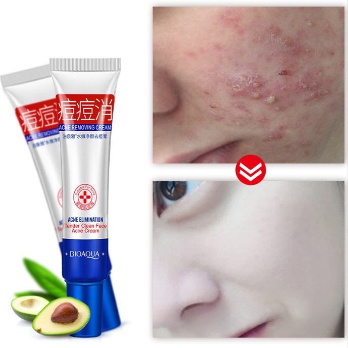 Kem Bôi Mụn Trứng Cá Mụn Bọc Mụn Thâm Bioaqua