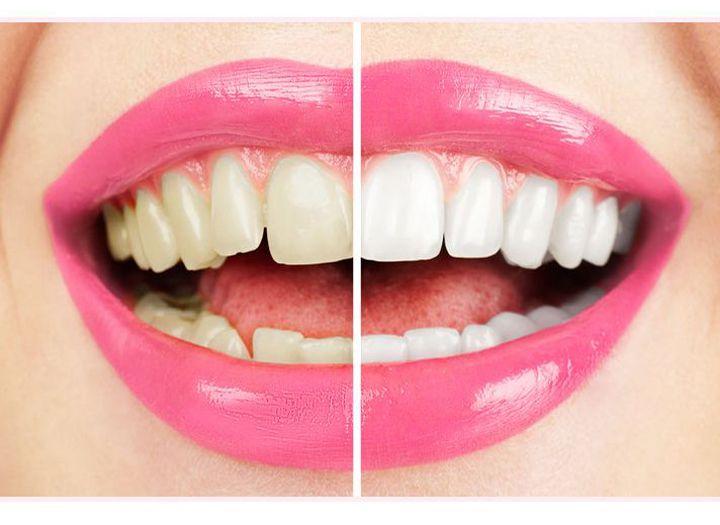 Kem đánh răng dành cho người hút thuốc White Glo Smokers' Formula Toothpaste 100ml