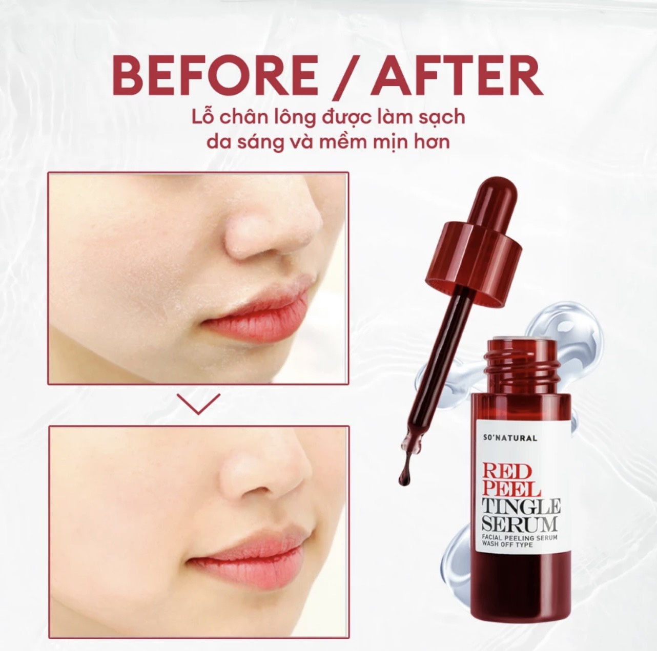 Tinh Chất Red Peel Tingle Serum 11ML PHIÊN BẢN MỚI