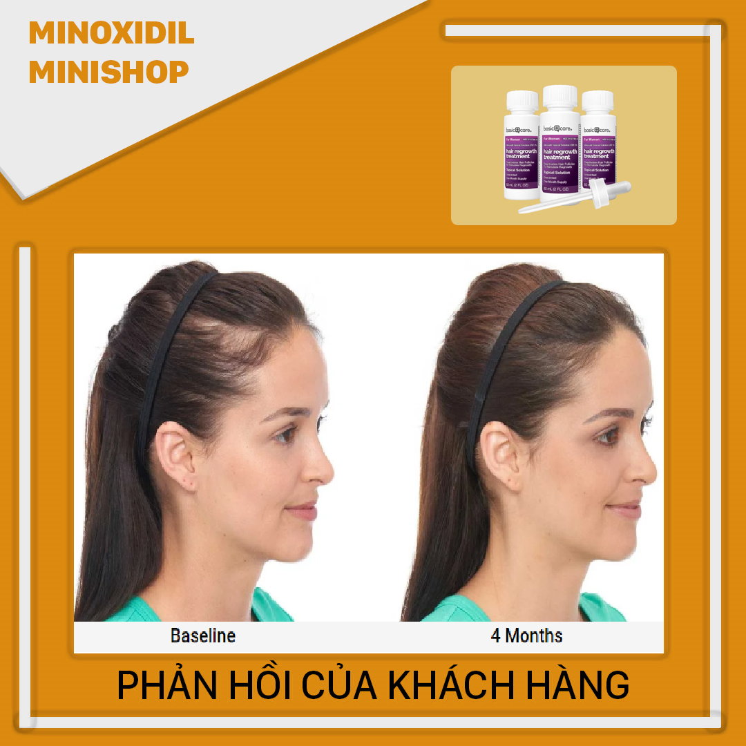 Dung dịch Mọc Tóc, Lông Mày Minoxidil 2% Cho Nữ Basic Care
