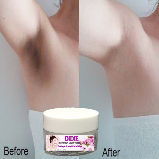 [HCM]Kem Dưỡng Trắng Nách Xóa Thâm Mịn Da DIDIE