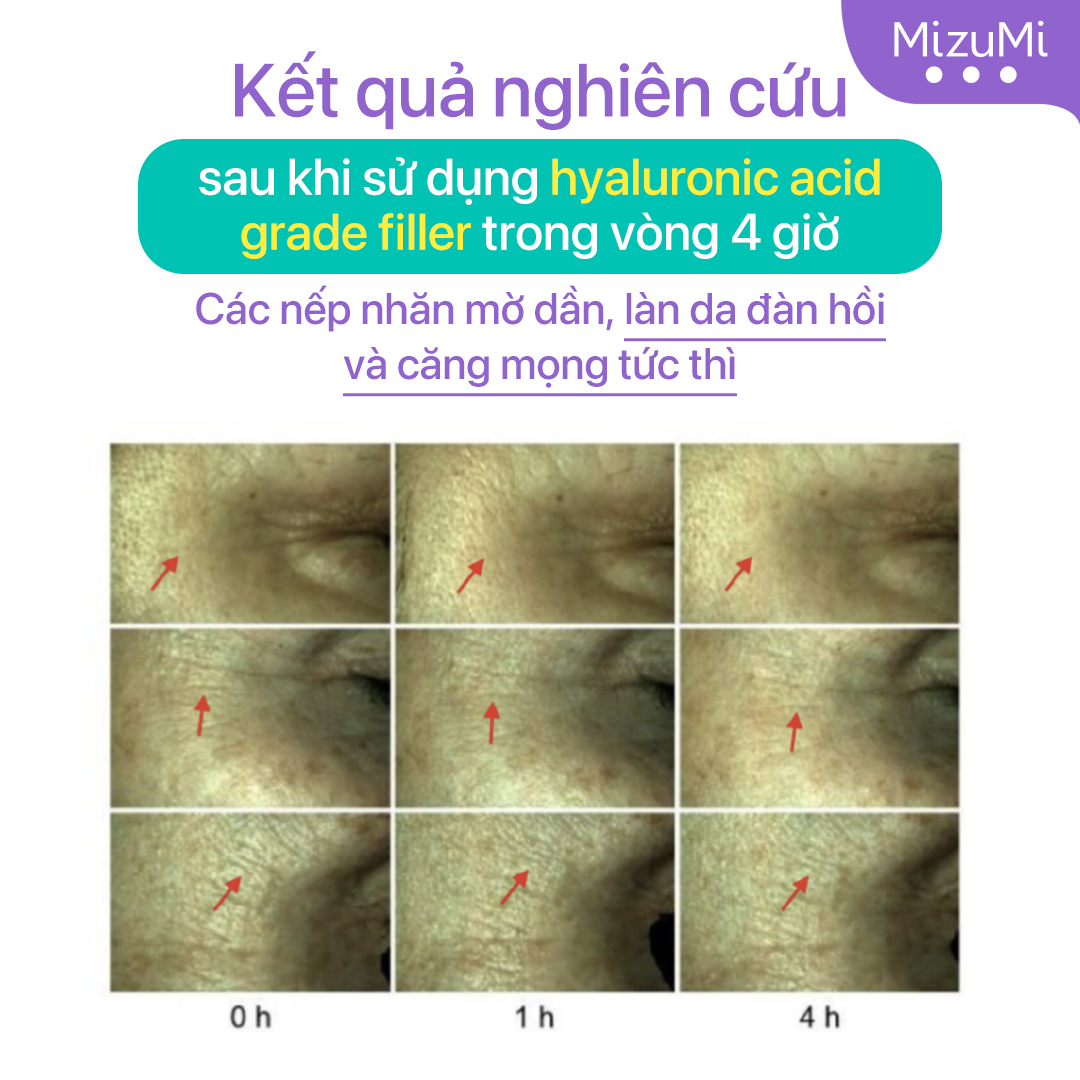 [GIFT] MizuMi Serum Dưỡng Ẩm Hya Acne Repair Serum 6g