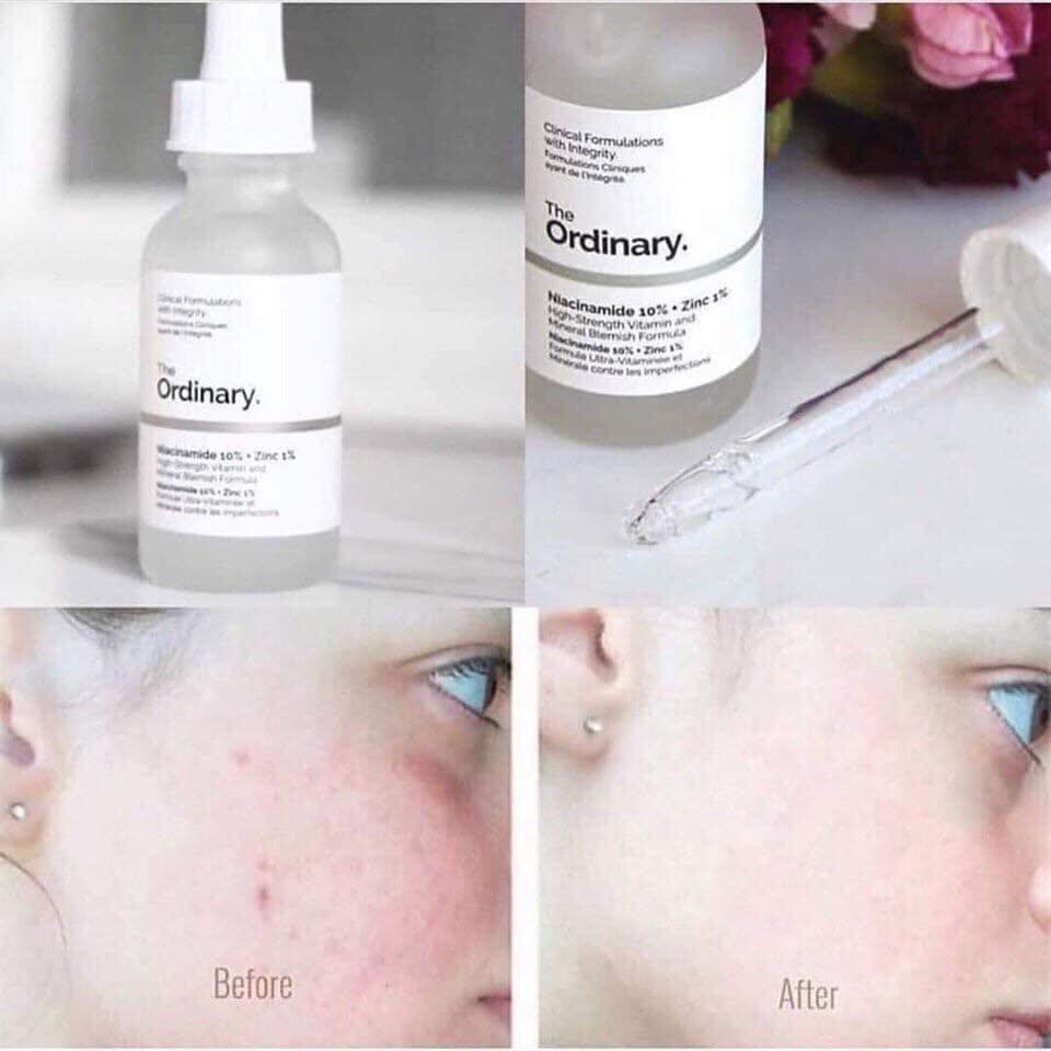 [HCM]The Ordinary Niacinamide 10% + Zinc 1% 30ml