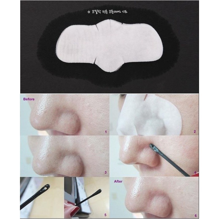 Miếng lột mụn đầu đen CIRACLE Good Bye Blackhead 5ml​ Hàn Quốc﻿ (1 miếng)