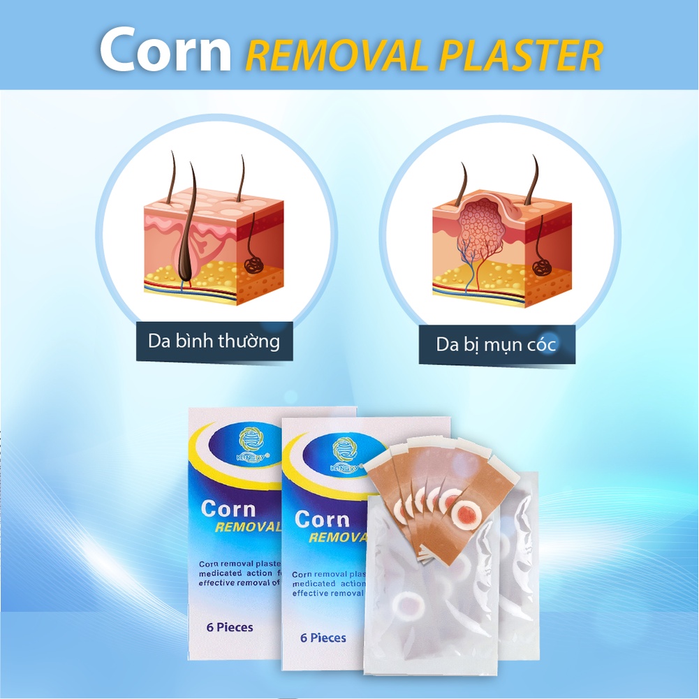 Miếng Dán Mụn Cóc Tại Nhà Corn Removal Plaster ( Hộp 6 Miếng )