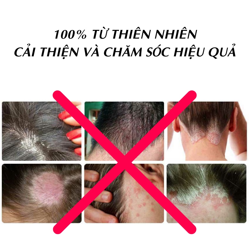 Quả bồ kết khô 500g - Thảo Dược Tấn phát - Hàng công ty chất lượng cao - Giúp bạn có một mái tóc khỏe mạnh