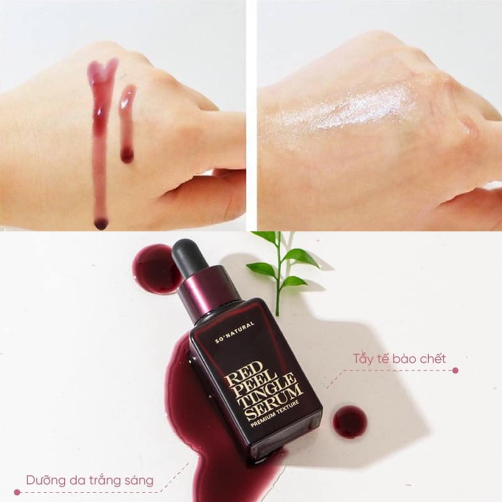 [So'natural] Tinh Chất Red Peel Tingle Serum Sonatural Hàn Quốc