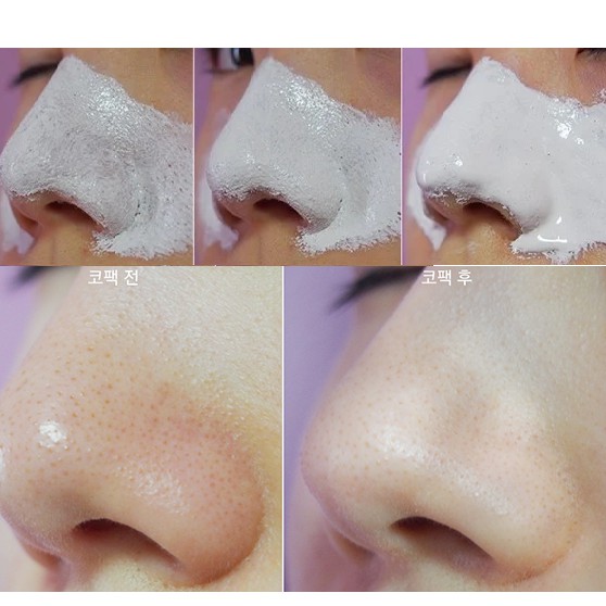 Kem lột mụn cám, mụn đầu đen PEELING PACK