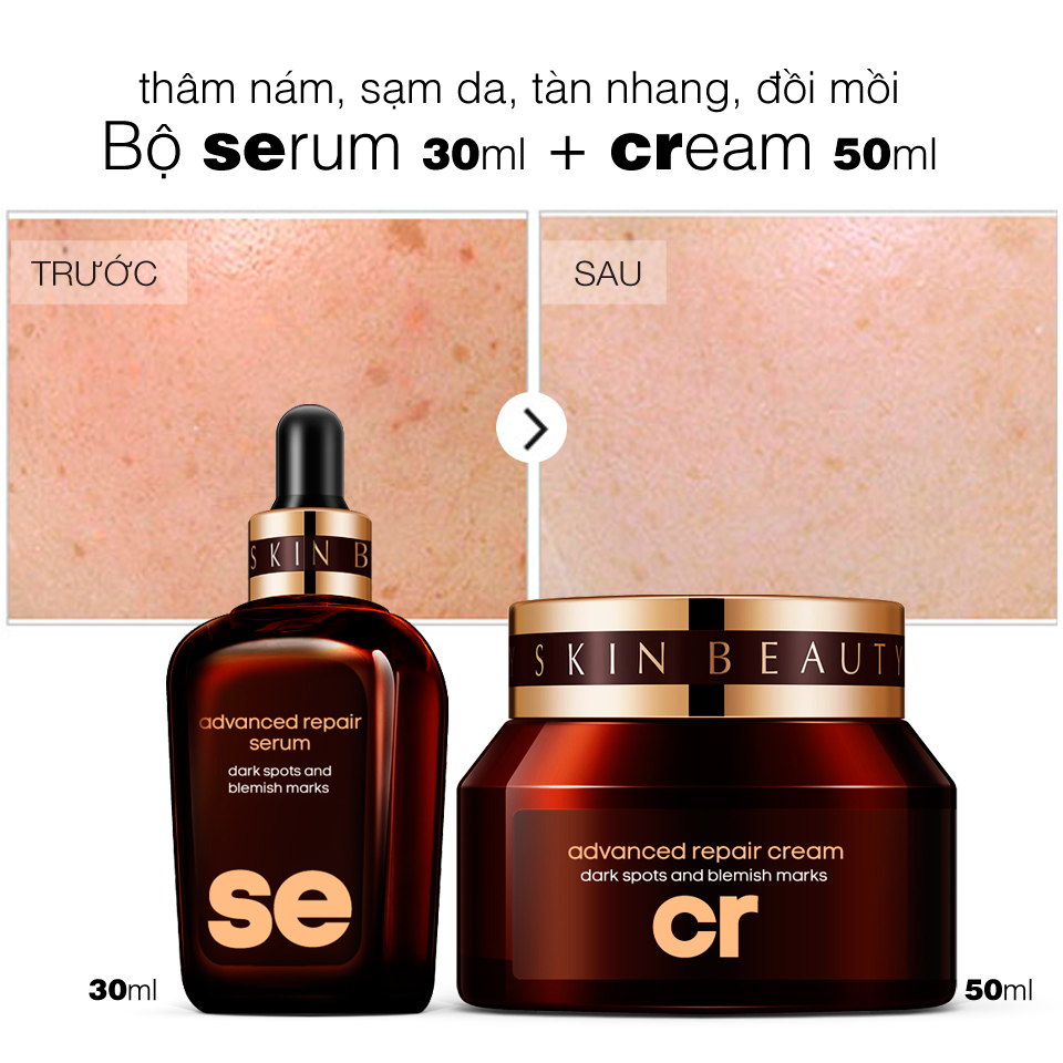 LANGCE Pack Dark Spots Corrector and Blemish Mark 30ml+50ml for MEN