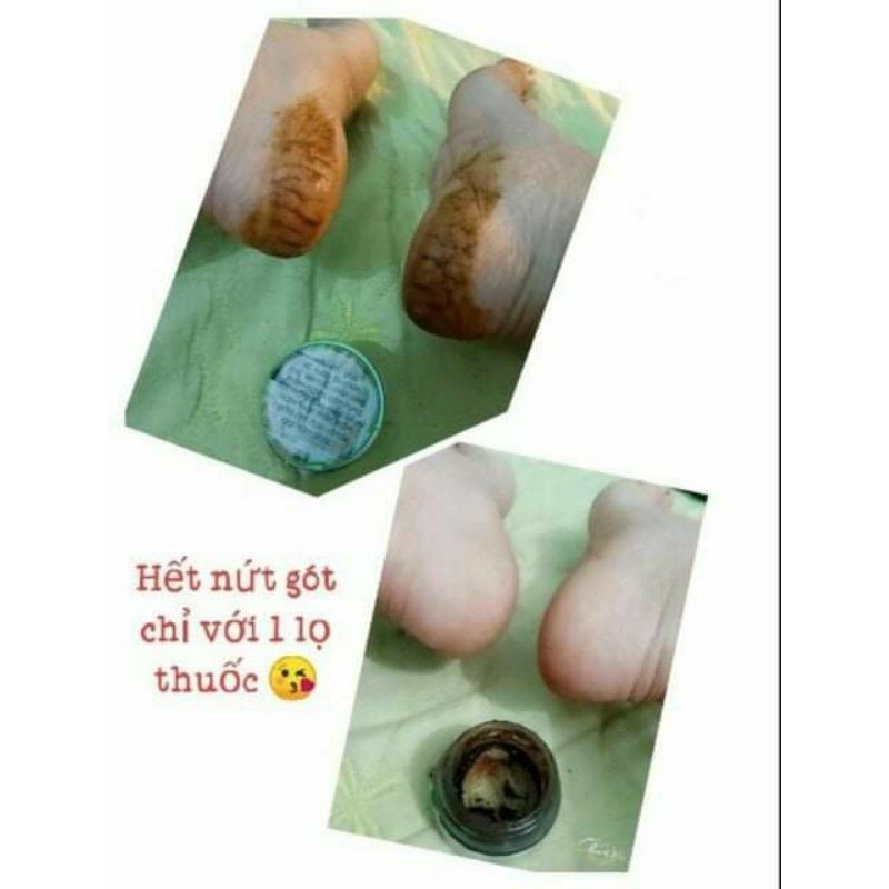 THẢO MỘC BÔI DA THIÊN NHIÊN TKH