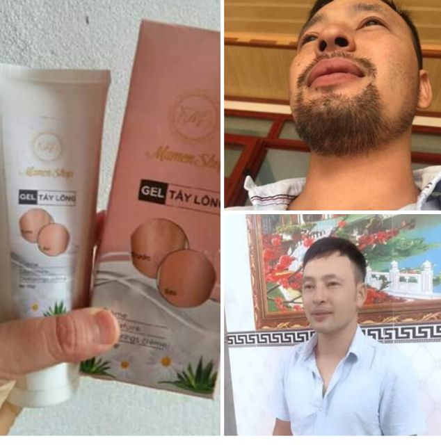 Kem Triệt  Râu Lông Vĩnh Viễn Trắng Da Không Mọc Lại Thiên Nhiên 120ml