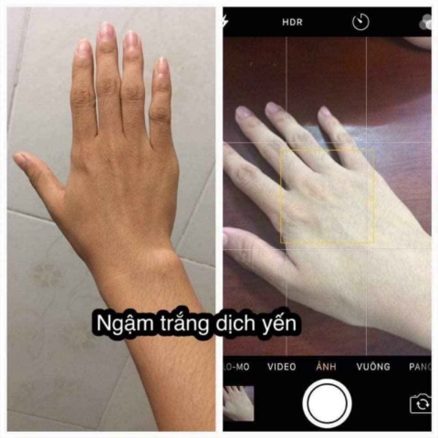 ngậm trắng dịch yến chuyên sỉ spa