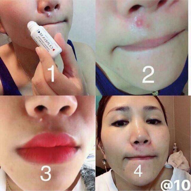 Serum chấm mụn Clinda M 15ml THÁI LAN