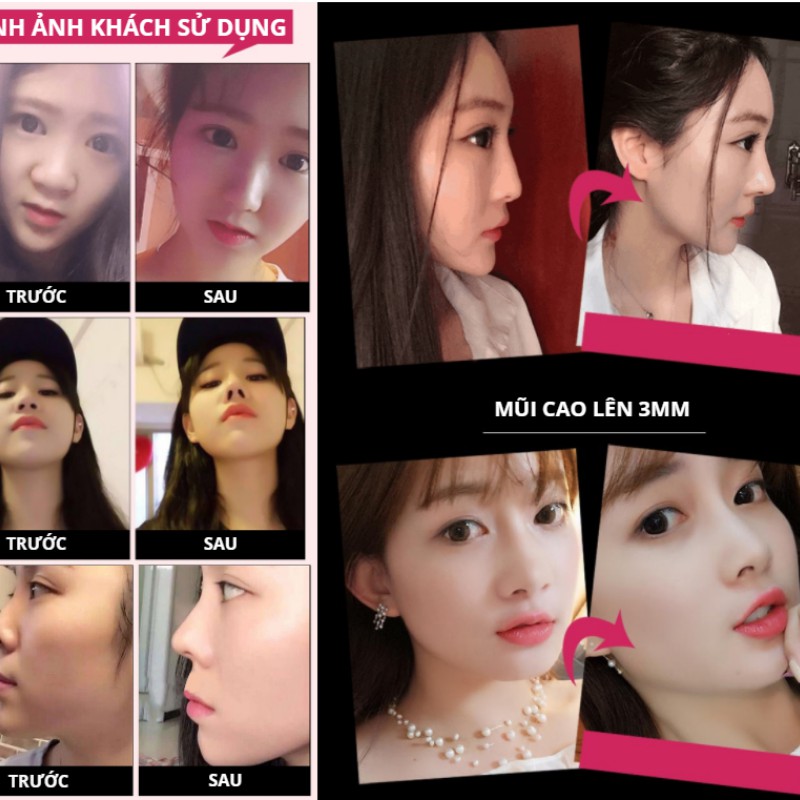 [Hàng Nhật Bản sách tay] Nâng mũi , dụng cụ nâng mũi Nhật Bản