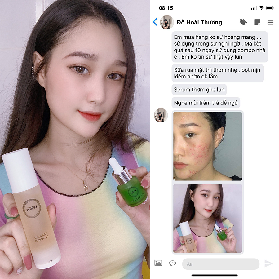 Serum Tràm Trà Venus 15ml sạch mụn & mờ thâm trắng da