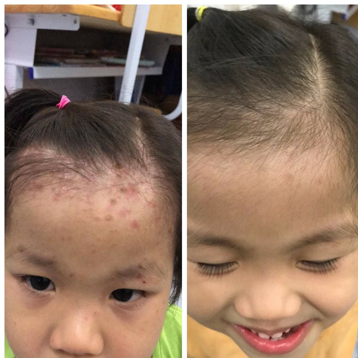Nước tắm thảo dược trị rôm sảy Tamrom