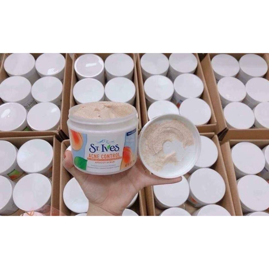 [HÀNG HOT] Tẩy tế bào chết toàn thân ST.ives