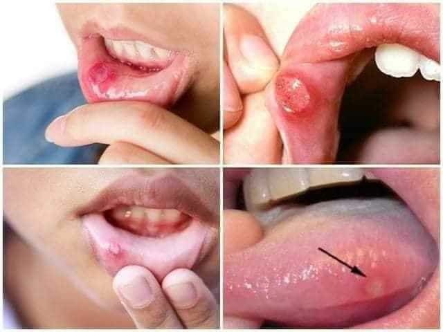 Sản phẩm Răng miệng An Khánh Tâm