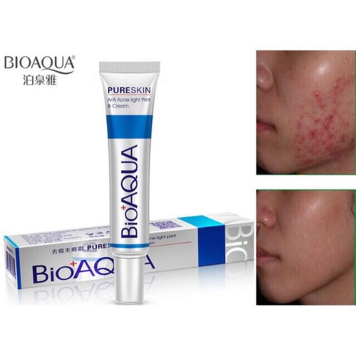 Kem Mụn Trứng Cá Pure Skin Bioaqua