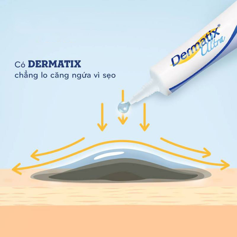 Kem sẹo Dermatix Ultra 15G