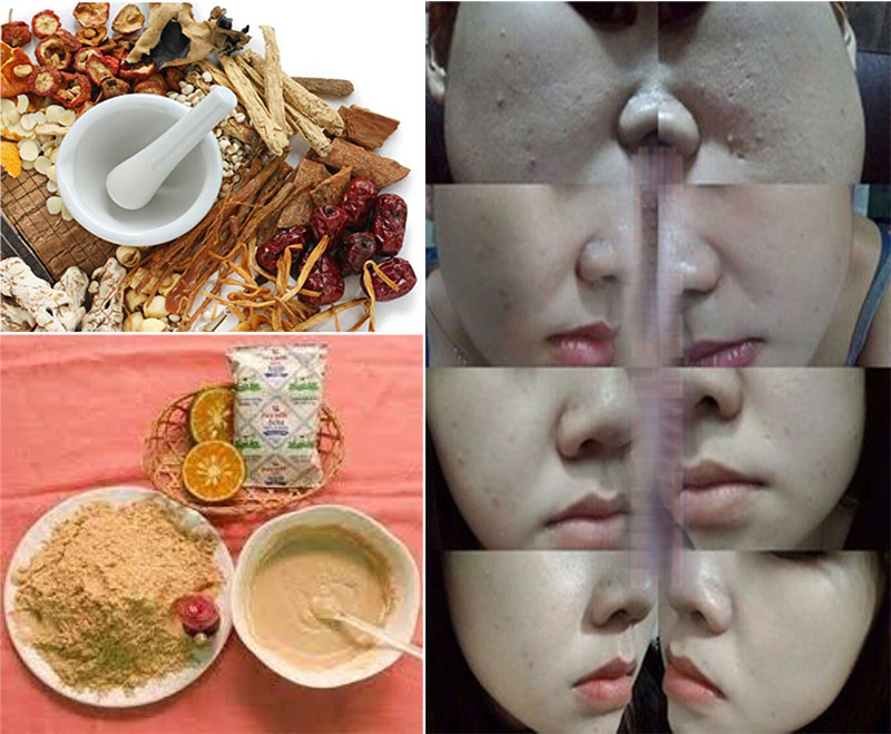 1KG Bột tthuốc bắc (mặt nạ và tắm trắng) - Tặng 100G bột trà xanh.