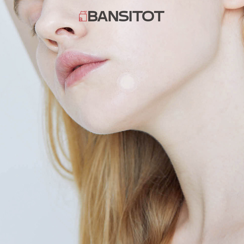 (EXP: 07/2023) Miếng dán mụn NEEDLY Patch Anti-trouble Get Rid Of_Acne Patch