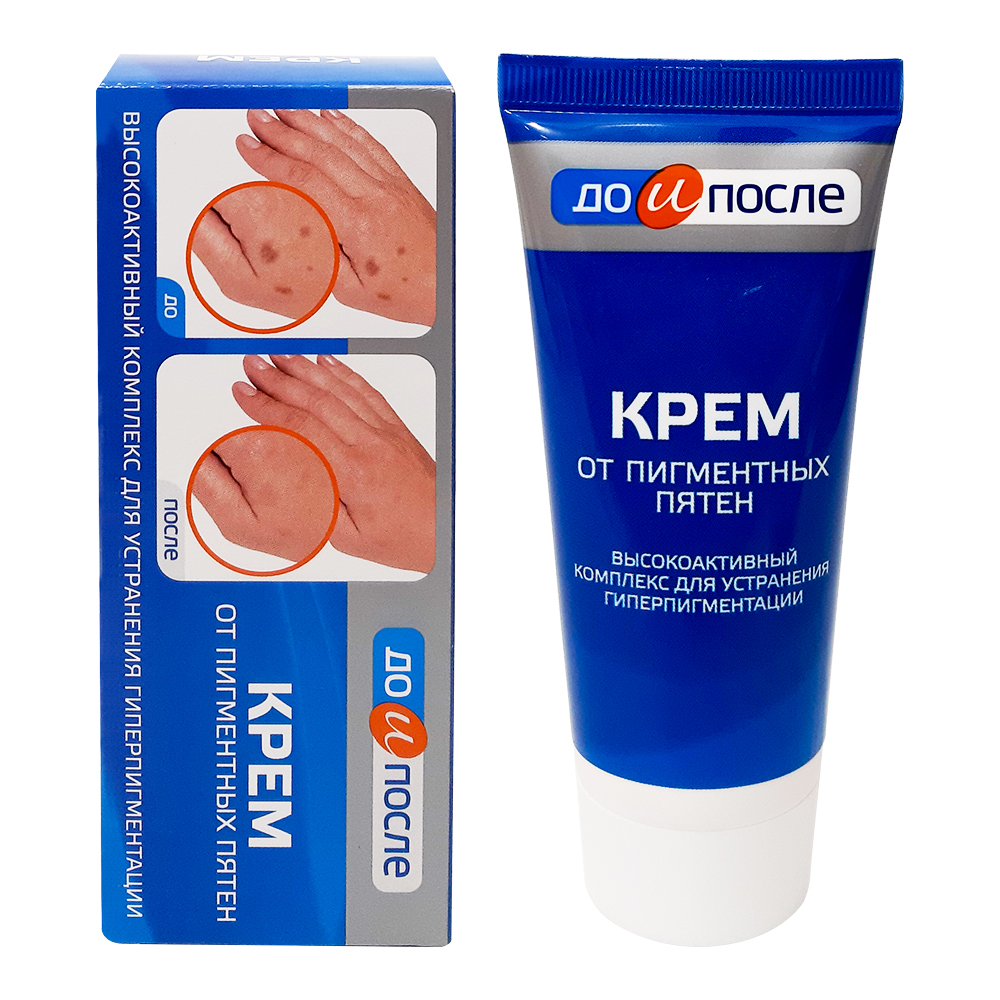 Kem đồi mồi kpem Nga 50ml xóa mờ đồi mồi tay, tàn nhang dưỡng da tay trắng sáng mịn màng