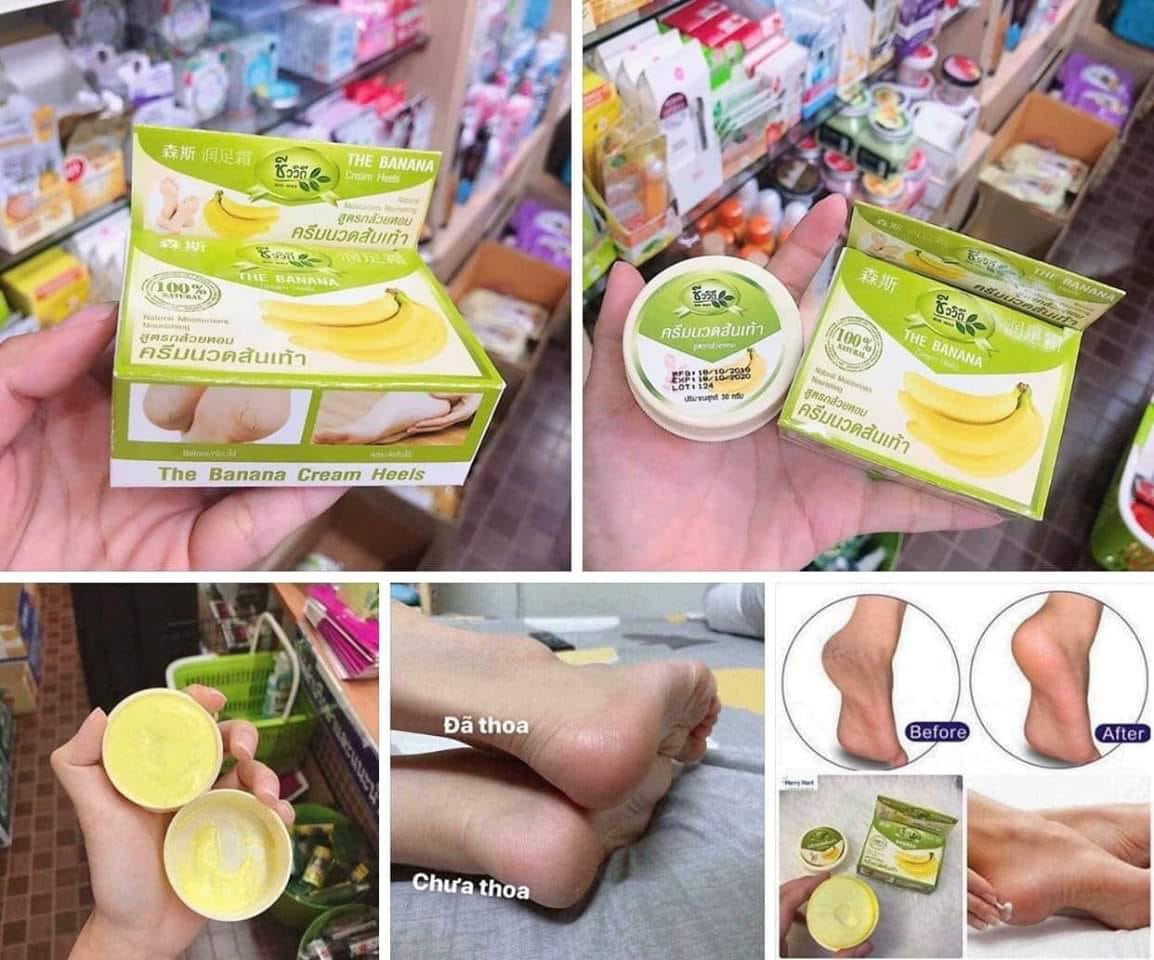 KEM CHUỐI Bôi Nứt Gót Chân Thái Lan