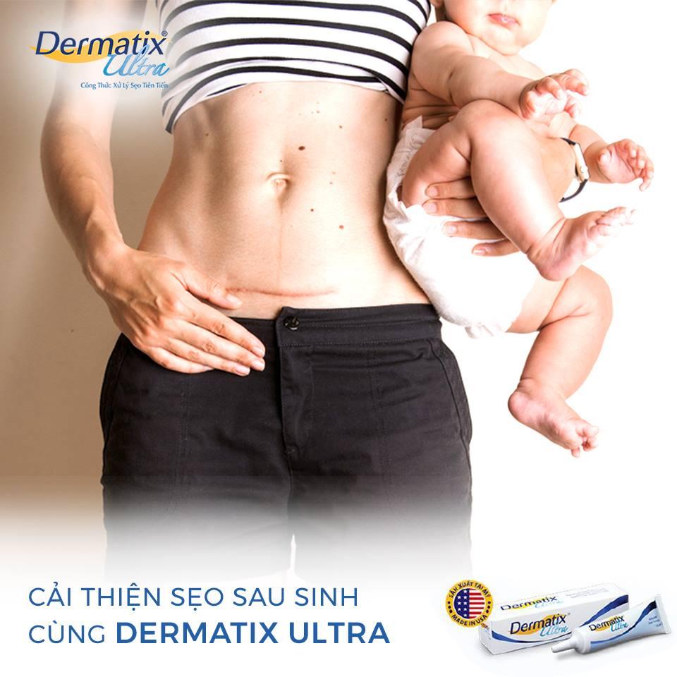 [GIẢM 20K ĐƠN 399K] Dermatix Ultra Gel Làm Mờ Sẹo 7g