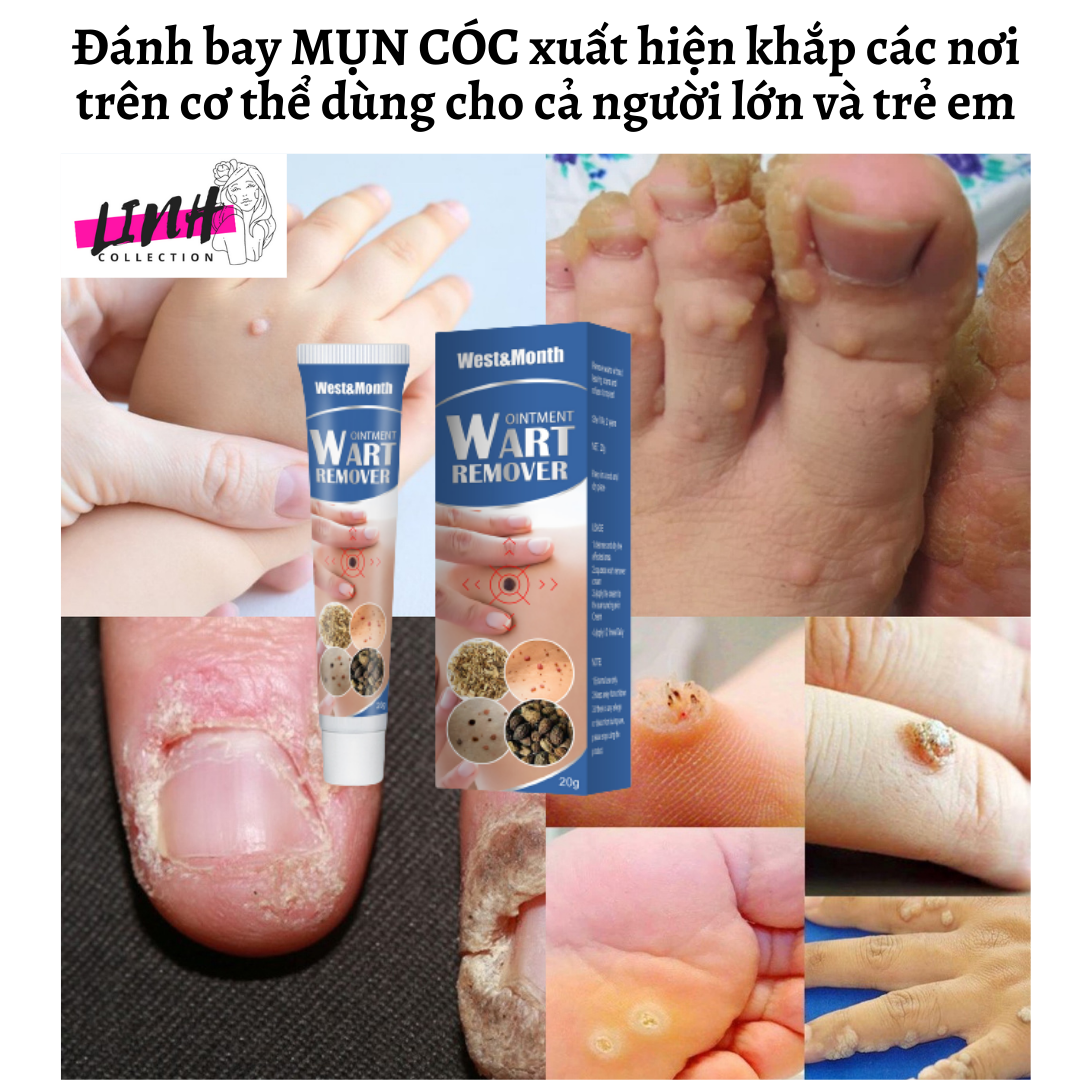{ĐÁNH BẬT} MỤN CÓC, MỤN THỊT,MỤN CƠM,MỤN RUỒI TRÂU REMOVE EVERY WARTS CHÍNH HÃNG