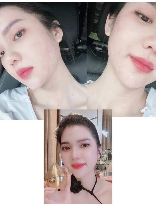 Kem face ủ trắng GLUO FACE WHITENING CREAM