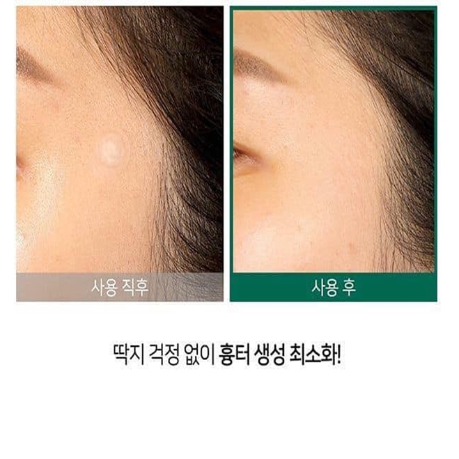 Miếng dán mụn Some By Mi