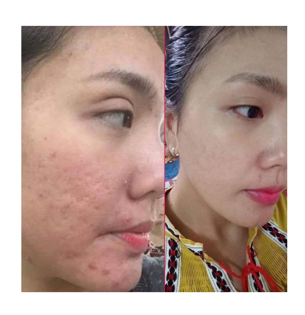 Kem Dưỡng Trắng Da Mặt White Face Của Thái Lan