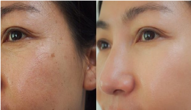 Trà dưỡng nhan( trà hoa cúc, táo đỏ)