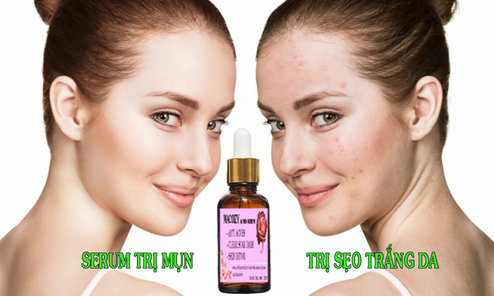 [HCM]Serum Giảm Mụn Mờ Thâm Macoizy Của Pháp