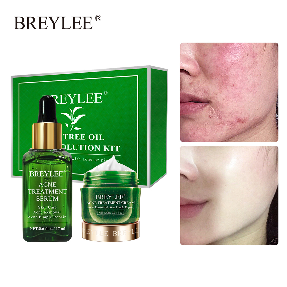 BREYLEE Bộ mỹ phẩm hỗ trợ làm giảm mụn