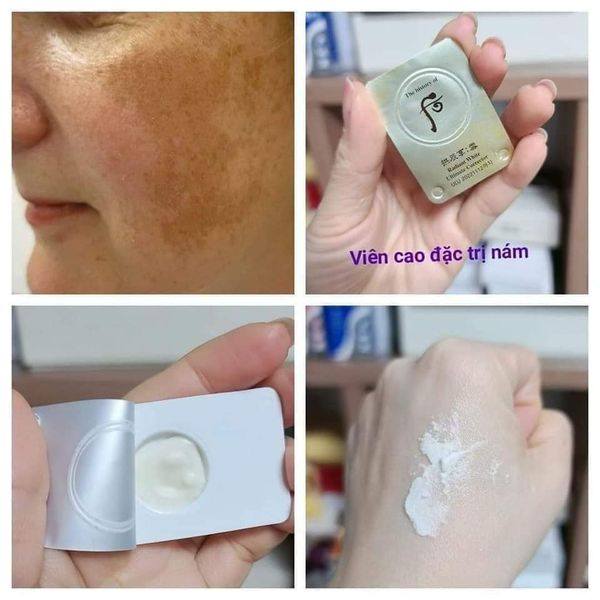 Combo 10 vỉ cao nám whoo radiant white intensive spot corrector