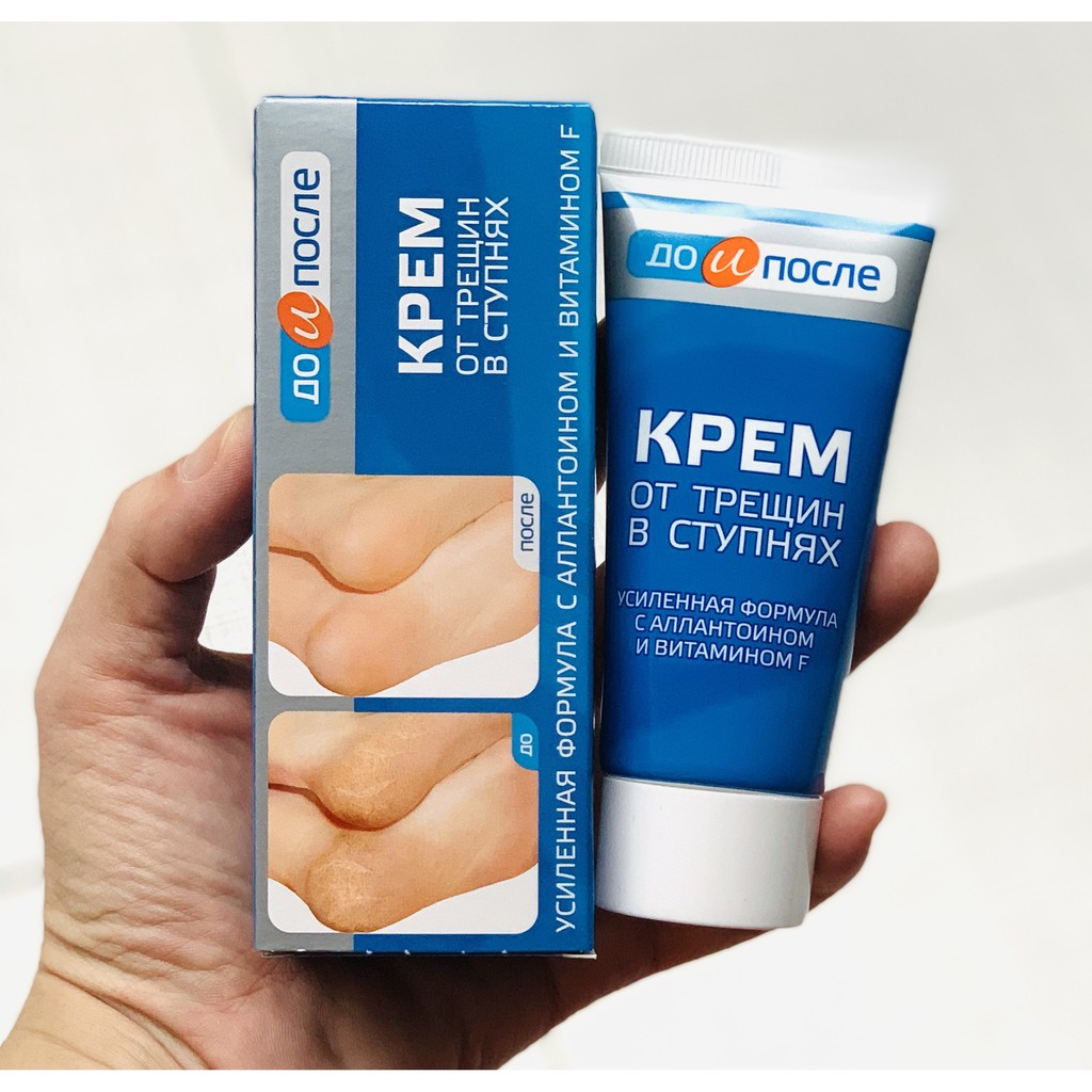 Kem Giảm Nứt Gót Chân Nga Kpem 50ml