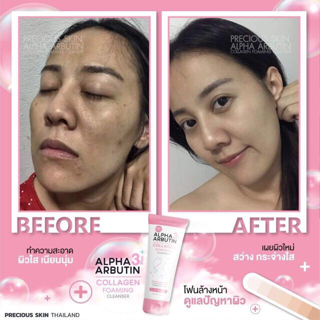 SỮA RỬA MẶT ALPHA ARBUTIN - Mediworld.store