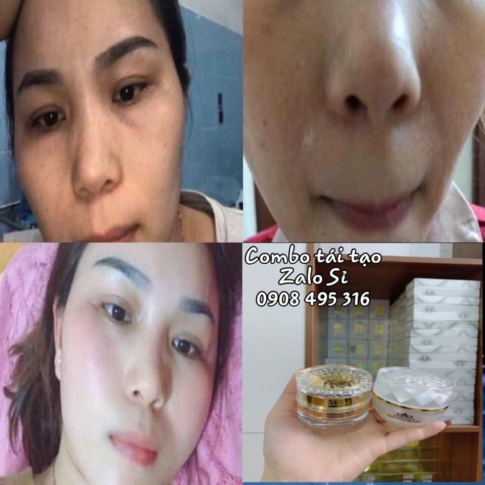 [HCM]COMBO TÁI TẠO và KEM HỒNG SÂM CHAMOMILESKILL