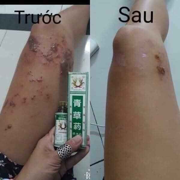 Dầu Bông Lúa MINYAK Thái Lan
