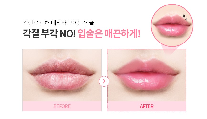 Son Dưỡng Môi YNM Candy Honey Lip Balm