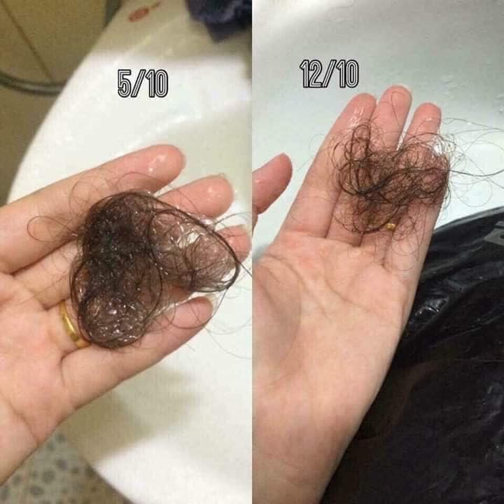 Bộ Dầu gội xã BIOTIN mỹ