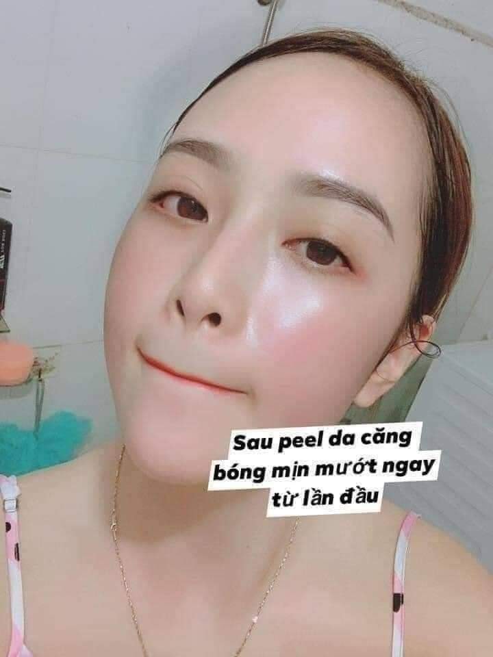 TẨY TBC PEEL CAFE BEIGIC