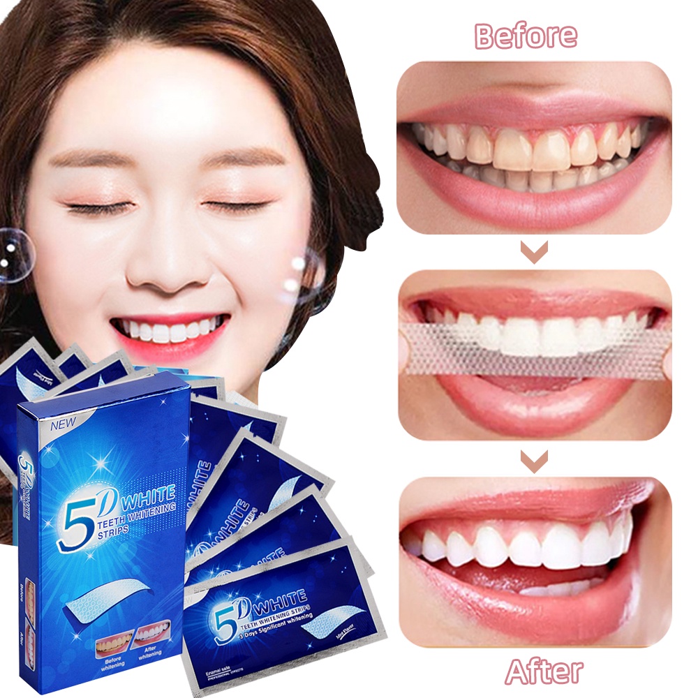 Hộp miếng dán trắng răng 5d white smilekit làm trắng răng rõ rệt sau 3 ngày sử dụng, loại bỏ ố vàng, an toàn, hiệu quả, tiện lợi
