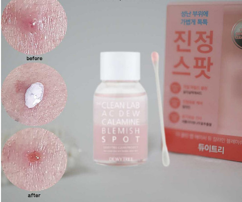 Chấm mụn DEWYTREE THE CLEAN LAB AC DEW CALAMINE SPOT