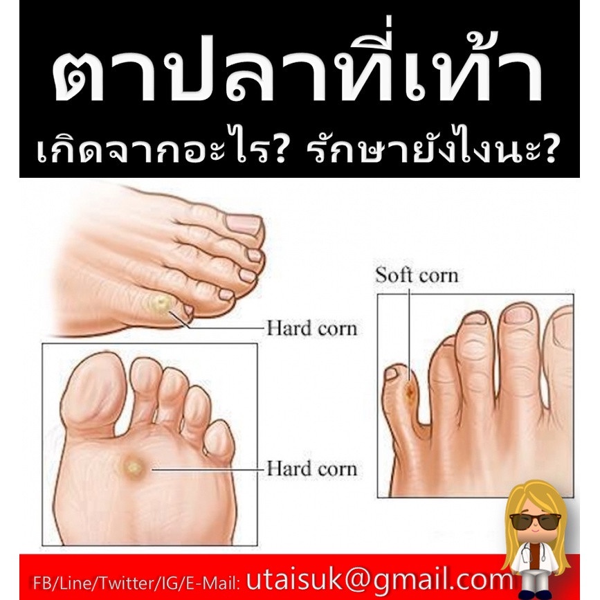 MỤN  CON CON THÁI LAN CHAI 15ML