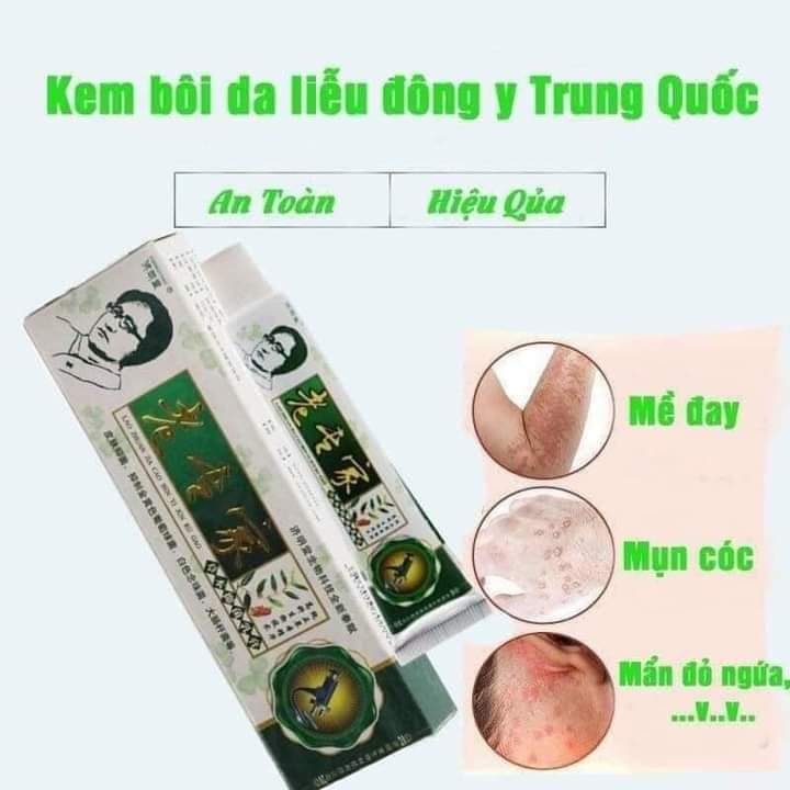 Kem bôi ngứa ông gìa nội địa trung xóa nấm, mề đay, viêm da
